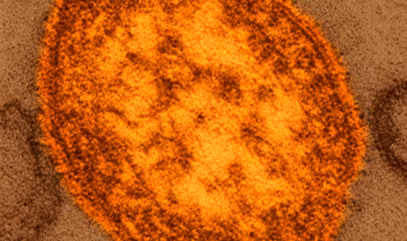 US measles cases top 4,800 as the disease surges in multiple states
